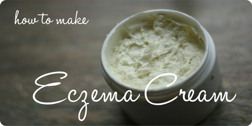 How-to-Make-Eczema-Cream-500